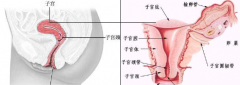 当医生告诉你宫颈管消失预示着要分娩了